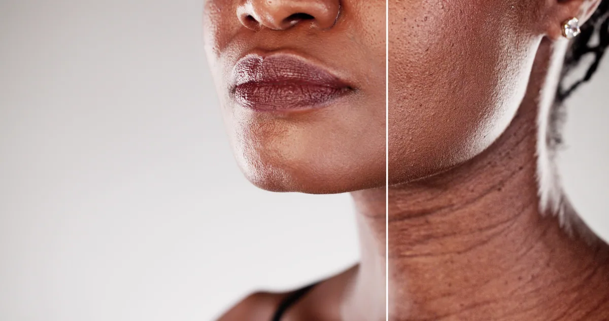 A calm, even complexion