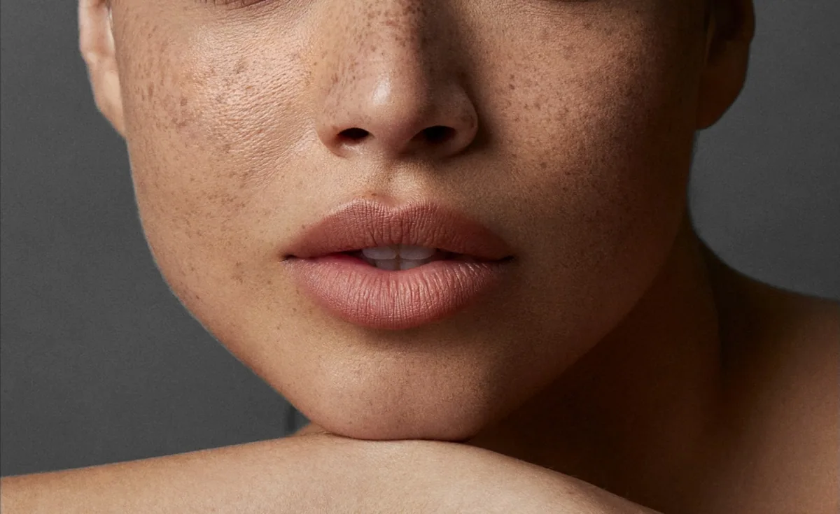 Skin in daylight, close up