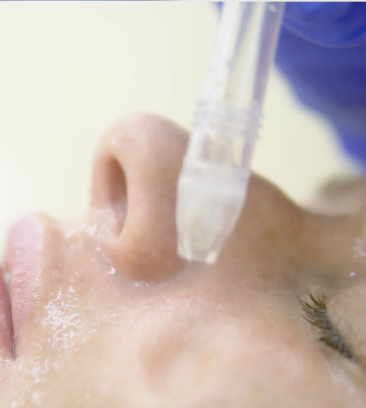 A facial treatment in progress